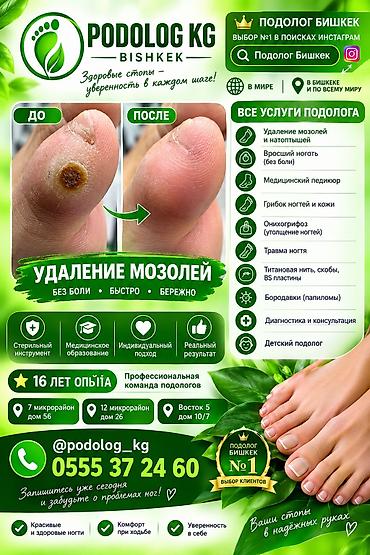удаление папилломы бишкек: Коррекция вросших ногтей, Услуги подолога, Одноразовые расходные материалы — 2