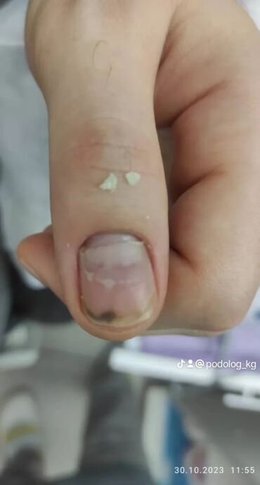 Маникюр, педикюр: Коррекция вросших ногтей, Выравнивание, Услуги подолога, Маникюр, Педикюр, С выездом на дом, Консультация, Одноразовые расходные материалы — 7