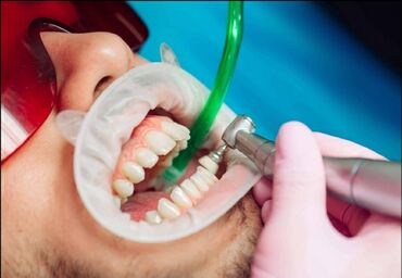 витилиго как лечить: Стоматолог | Реставрация, Протезирование, Чистка зубов | Консультация, Круглосуточно