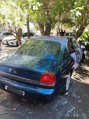 sonata 2003: Maşının beyininində problemi var, beyin tapa bilmirəm deyə parçalayıb — 3
