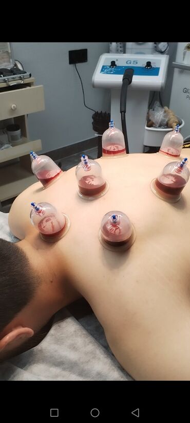 Hicama, zəli: İlk önce masaj hicama, zeli üzre bir mütexessis kimi onu deye bilerem — 3