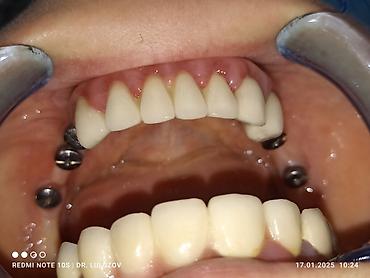 Медицинские услуги: Клиника | Стоматолог | Протезирование — 20