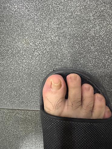 Маникюр, педикюр: Коррекция вросших ногтей, Услуги подолога, С выездом на дом, Консультация, Одноразовые расходные материалы — 9