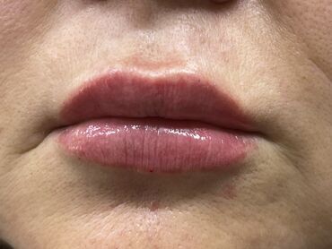 Косметика: Процедура перманентного макияжа губ позволяет придать губам желаемый — 7