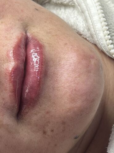 Косметика: Процедура перманентного макияжа губ позволяет придать губам желаемый — 47