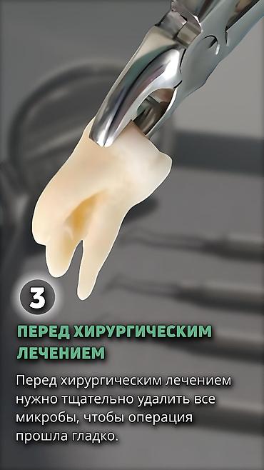 стоматологический апарат: Профессиональная гигиена полости рта и профилактический осмотр у — 6
