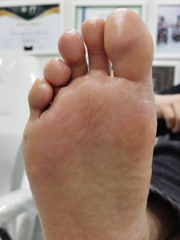 Маникюр, педикюр: Коррекция вросших ногтей, Педикюр, Услуги подолога, Консультация, Одноразовые расходные материалы — 7