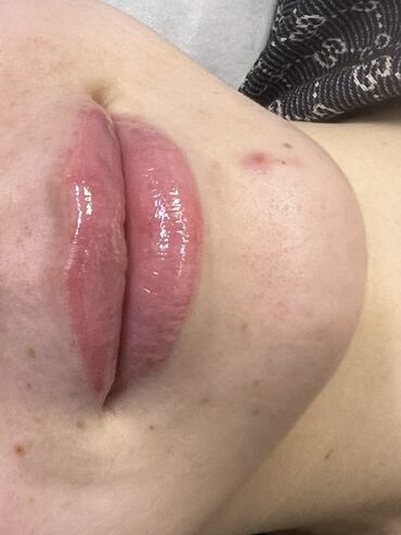 Косметология: Косметология, Маски, Мезотерапия, Удаление носогубных складок, Гипоаллергенные материалы, Консультация, Сертифицированный косметолог — 47