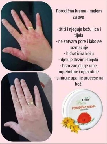 Nega kože: Porodicna krema🌼🌼🏖🏖 Prva pomoc gde god da ste👌 Bez nje ne smete biti🍀 — 5