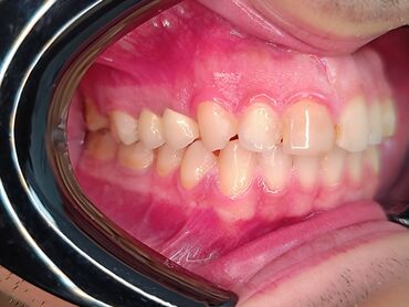 İşıqlandırma: Məhsul: Smartfon üçün diş həkimi çəkiliş seti – LED halqa işıqlı — 5