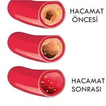 Hicama, zəli: Salam Aleykum.Yalnız Xanımları Hicama edirəm.Naməhrəmlər — 6