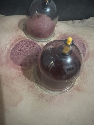 Masaj: Vakuum masajı, Qadınlar üçün — 8