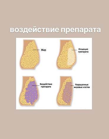 Красота и здоровье: Lipo Lab V-Line Solution — инъекционный липолитик для коррекции — 3