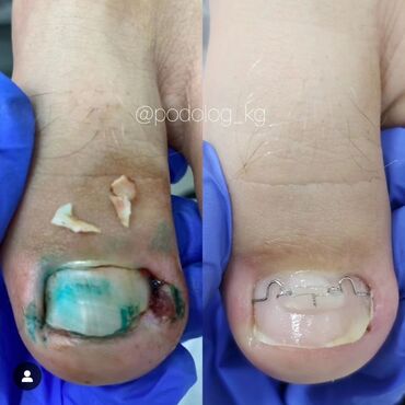 Маникюр, педикюр: Выравнивание, Наращивание ногтей, Донаращивание ногтей, Маникюр, Педикюр, Услуги подолога, С выездом на дом, Консультация, Одноразовые расходные материалы at lalafo.kg — 7 Маникюр, педикюр: Выравнивание, Наращивание ногтей, Донаращивание ногтей, Маникюр, Педикюр, Услуги подолога, С выездом на дом, Консультация, Одноразовые расходные материалы — 7