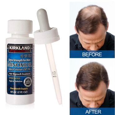 hommlife azərbaycan bakı fotolar: ✅KIRKLAND MINOXIDIL- COSTCO Mehsullarimiz tamamile originaldir ve