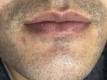 Косметика: Процедура перманентного макияжа губ позволяет придать губам желаемый — 51