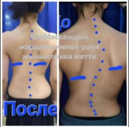 Массаж: Массаж | Остеохондроз — 9