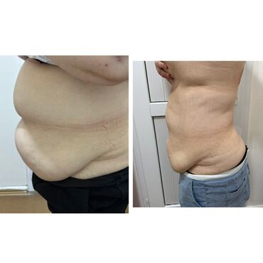 Hicama, zəli: Xidmət: Kupa terapiyası (quru və yaş/hicama), bel–boyun–çiyin masajı — 11