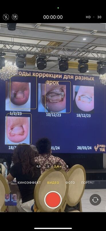 наращивание волос бишкек: Титановая нить