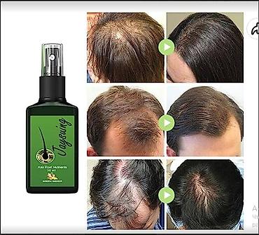 Уход за телом: США от выпадения для роста волос - вся инфа на фото оригинал прямые — 2