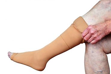 mualice: Varikoz müalicəsi, Klinikada — 3