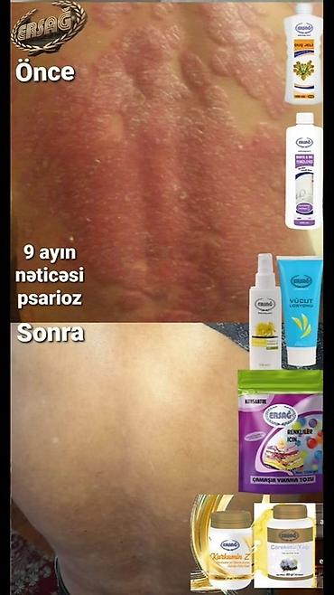 lonpasin kapsula: ERSAĞ qida və kosmetik dəstək məhsulları – seçilmiş bitkisel tərkiblər — 4