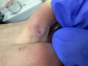 Маникюр, педикюр: Коррекция вросших ногтей, Педикюр, Услуги подолога, Консультация, Одноразовые расходные материалы — 6