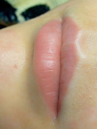 Косметология: Косметология, Биоревитализация, Ботулинотерапия, Контурное моделирование, Гипоаллергенные материалы, Консультация, Сертифицированный косметолог — 10