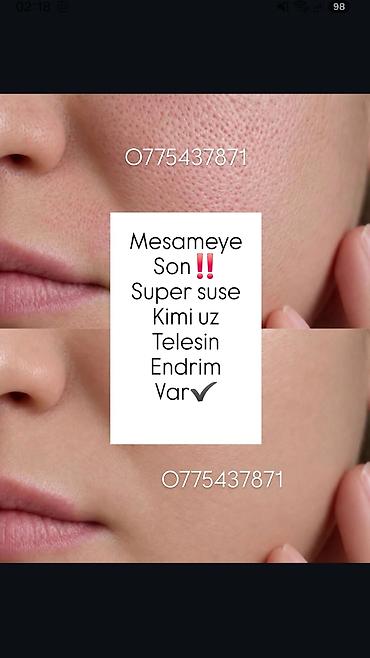 Kosmetologiya: Xidmət: “Mesoterapiya ilə məsamələrə son” proseduru Təsvir: - Üz — 1