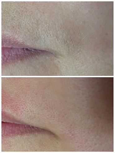 Другие услуги в сфере красоты и здоровья: Тридинг лица Тридинг — 11