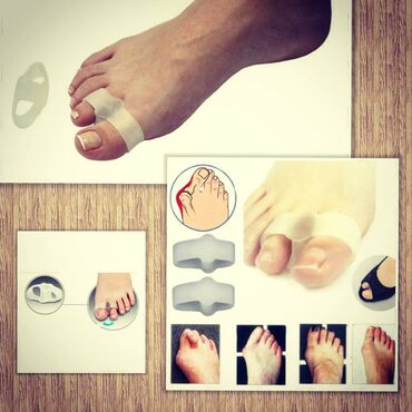 Вальгусные шины: Корректоры от косточки! — 6