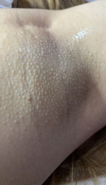 Эпиляция: Я мастер Ася 🍯 С опытом 3 года 🤝 Шугаринг Ламинирование бровей и — 18