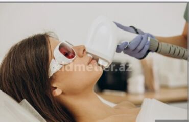 Inzibati heyət: Lazer ustası tələb olunur, Faiz, 3-5 illik təcrübə