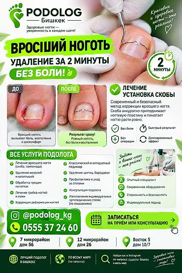 ПОДОЛОГ БИШКЕК ПОДОЛОГИЧЕСКИЕ УСЛУГИ: 🟢 ВРОСШИЙ НОГОТЬ БИШКЕК | БЕЗ
