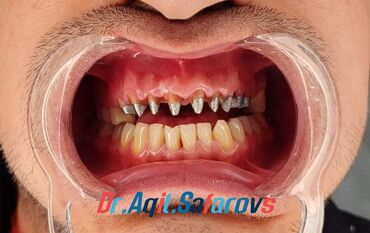 Stomatologiya: 💫Ramazan ayı ilə əlaqədar Kampaniya✨🌟⭐💫 🌊🔥Diş Həkimi 🔥🌊 Qiymətləri — 7