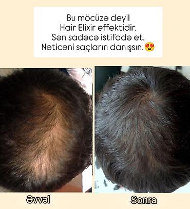 Bədənə qulluq: Əvvəlki fotodakı seyrəklik — bir çox insanın yaşadığı problemdir — 1