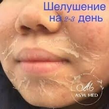 уход за волосами: ✨ Пилинг Джесснера — секрет сияющей и ровной кожи ✨ Хотите обновить