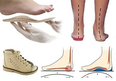 обувь ортопедическая: Стельки ортопедические(специализированные) от плоскостопия! Для