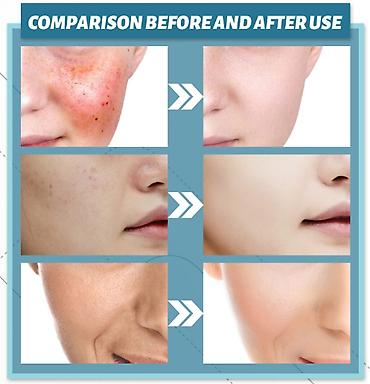 Уход за телом: ❄️ США Крем с керамидами антивозрастной увлажняющий Крем с керамидами — 8