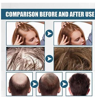 Уход за телом: США против выпадения волос ouhoe от облысения восстанавливающий спрей — 5