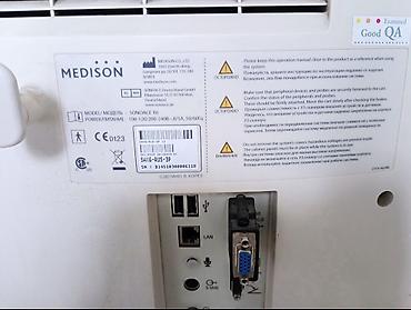 Медицинское оборудование: УЗИ-сканер Medison SONOACE X6 - Тип: стационарная ультразвуковая — 3