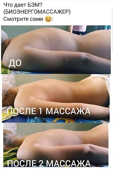 Острая боль в пояснице, ногах, грыжа. не поднимаются руки. Тогда