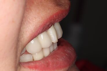 ассистент стоматолога: Врач-стоматологко ассистент керек