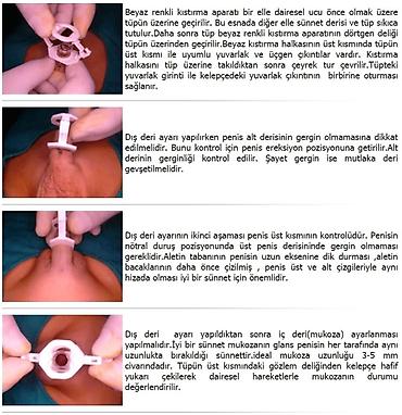 sunnet xoncasi: Oğlan uşaqları üçün zərif sünnət geyim dəsti - Üslub: Osmanlı — 9