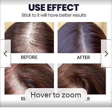 Уход за телом: США против выпадения волос ouhoe от облысения восстанавливающий спрей — 13