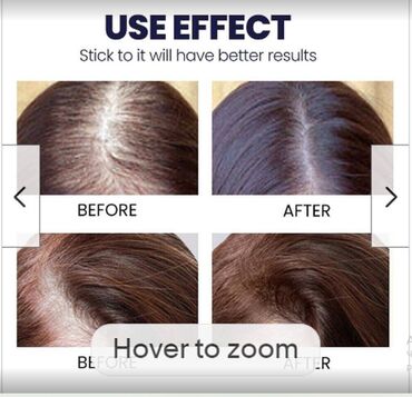 Уход за телом: США Спрей от выпадения волос влюсомс волосы для волос цена- 400 — 5