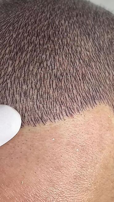 mühafizə xidməti: Tatto nökte atişiylariyla tük effekti yaradib keçelliyi örten — 4