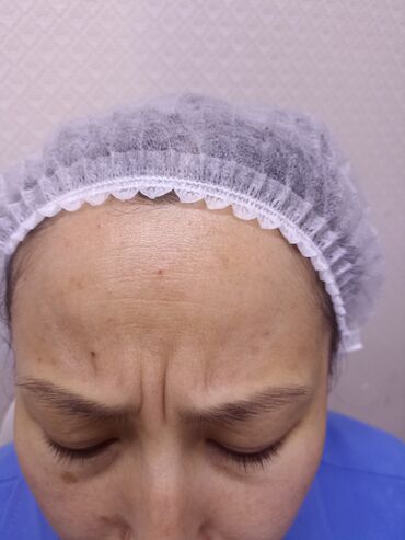 ботокс для волос: Косметолог | Ботокс, Ботулинотерапия, Лифтинг | Консультация, Гипоаллергенные материалы, Сертифицированный косметолог