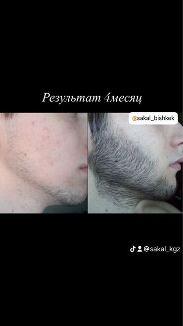уход за волосами: Сыворотка для роста бороды и волос RIJAL REAXIDIL 15% Minoxidil Что