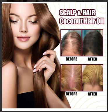 Уход за телом: США От облысения для волос от выпадения волос - смотрим фото читаем — 1